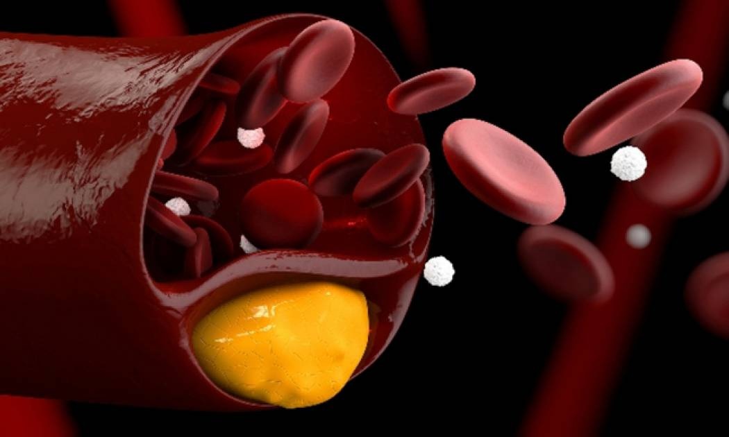 Οι χειρότερες τροφές για τη χοληστερόλη σας (pics)