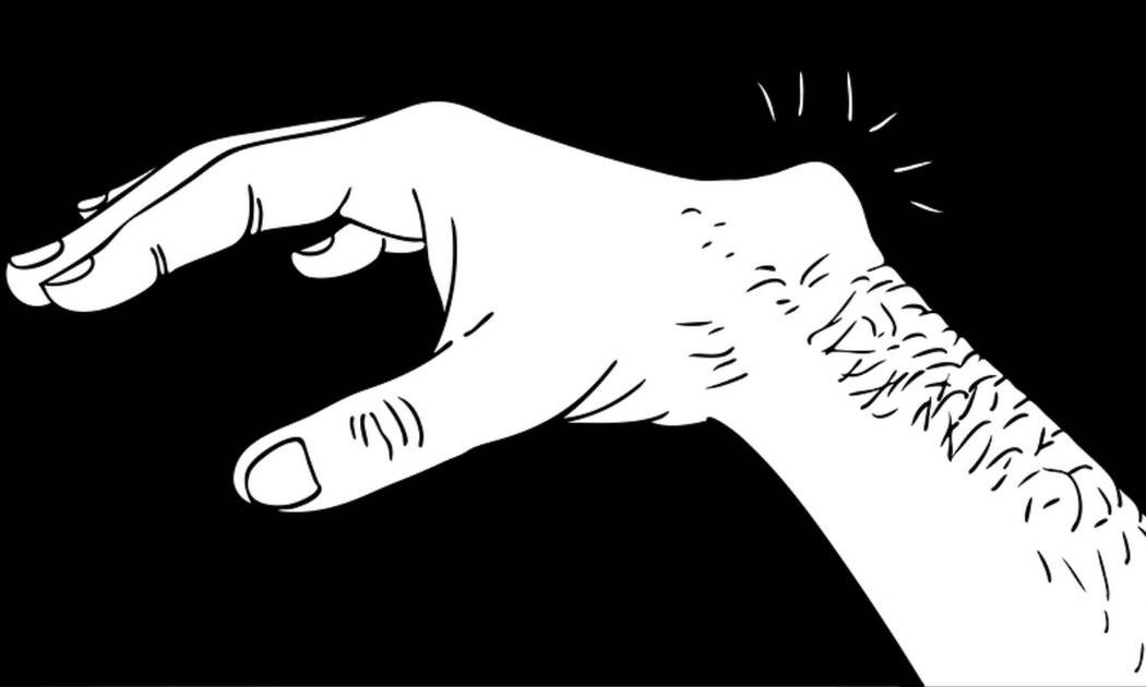 Γάγγλιο καρπού: Πόσο ανησυχητικό είναι; (video)