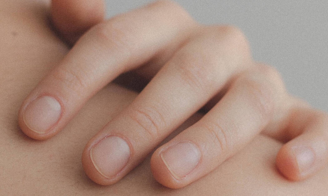 5 χαρακτηριστικά που σε κάνουν να διακρίνεις ένα μελάνωμα