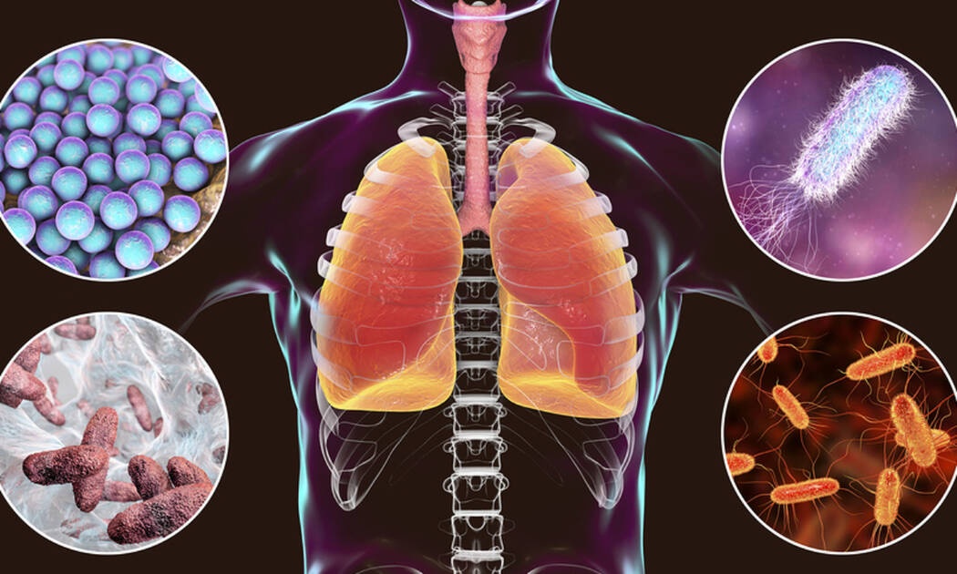 Λοίμωξη από σταφυλόκοκκο: 6 συμπτώματα σε εικόνες