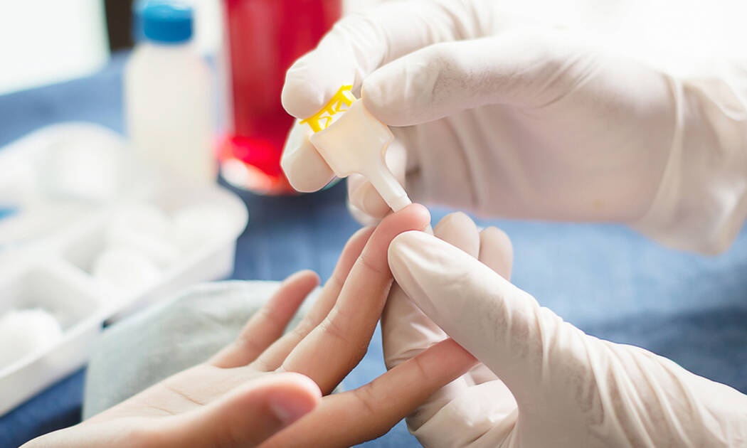 Θρομβοπενία: 6 λόγοι που την προκαλούν (εικόνες)