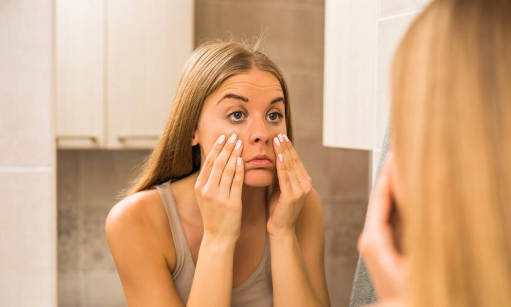 Μαύροι κύκλοι: 4 τρόποι για να τους εξαφανίσετε! (εικόνες)