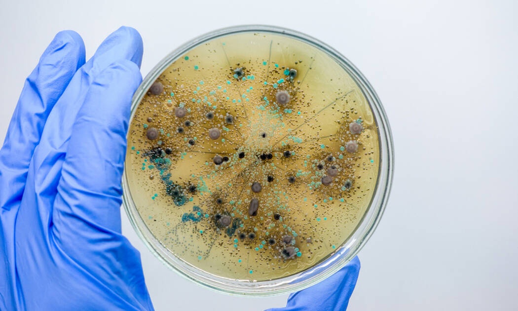 4 βρώμικα αντικείμενα καθημερινής χρήσης (εικόνες)