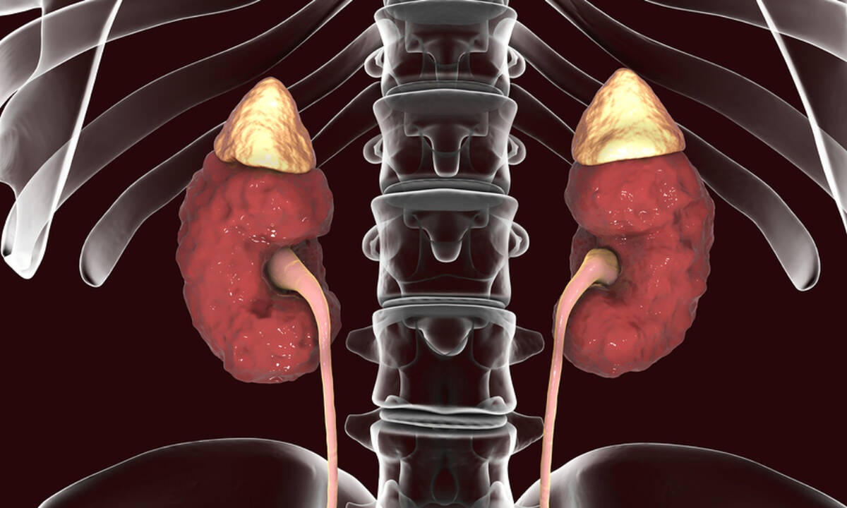 5 «αθώες» συνήθειες που βάζουν σε κίνδυνο τα νεφρά σας (εικόνες)