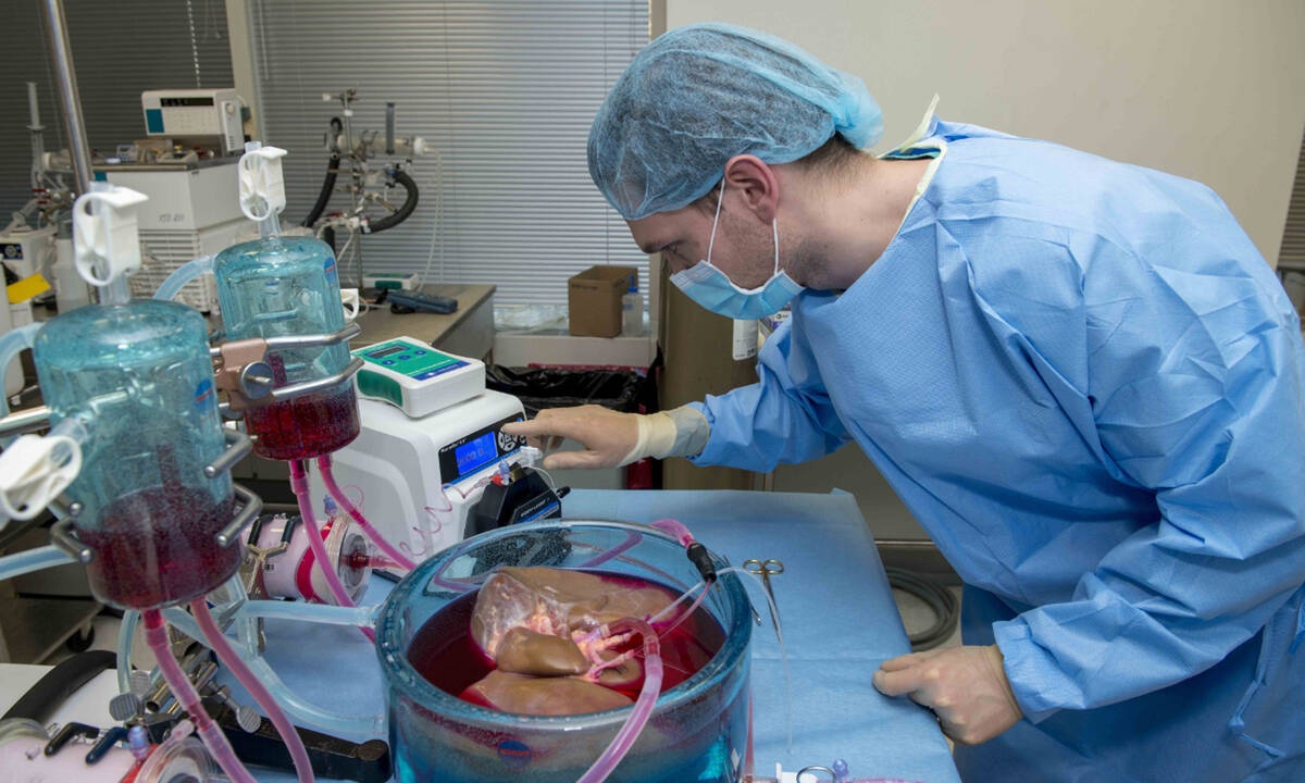Μεταμόσχευση: Νέα μέθοδος κρυοσυντήρησης τριπλασιάζει το χρόνο διατήρησης του μοσχεύματος
