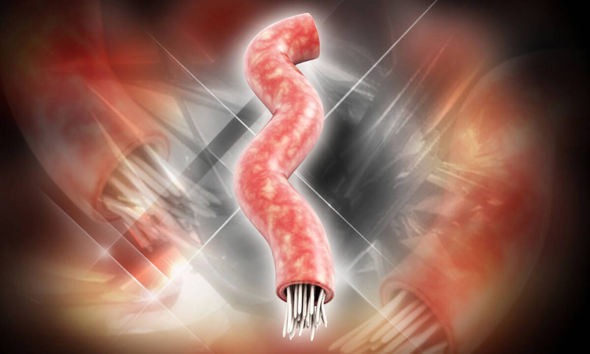 Παράσιτα στο έντερο: 9 συμπτώματα που πρέπει να γνωρίζετε (εικόνες)