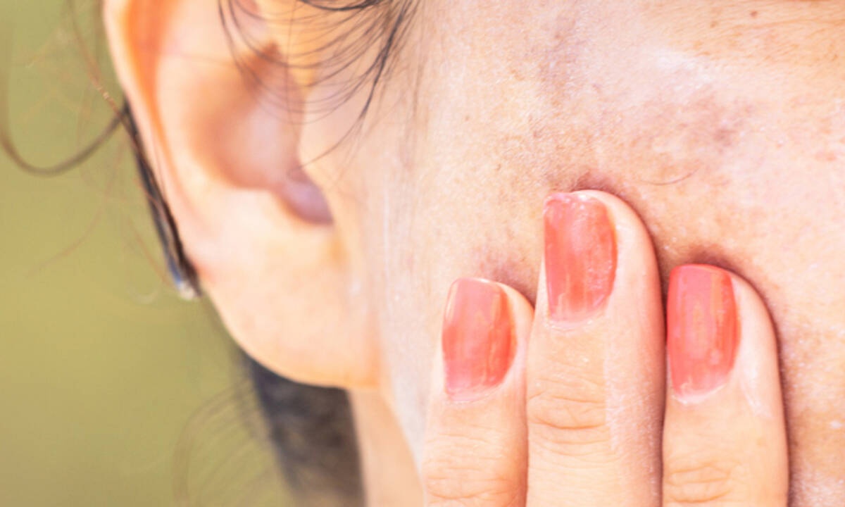 Σημάδια φωτογήρανσης : 5 φυσικοί τρόποι αντιμετώπισης (εικόνες)