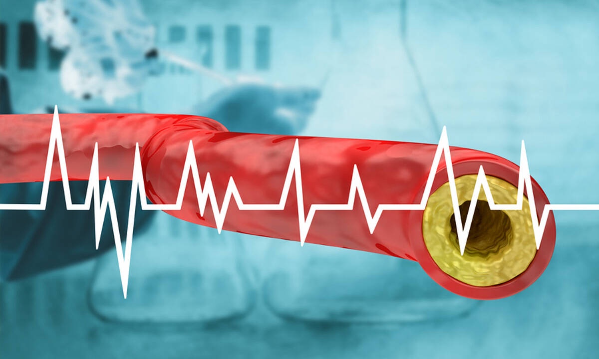 Υψηλή χοληστερόλη: 7 σημάδια που δεν πρέπει να αγνοείτε (video)