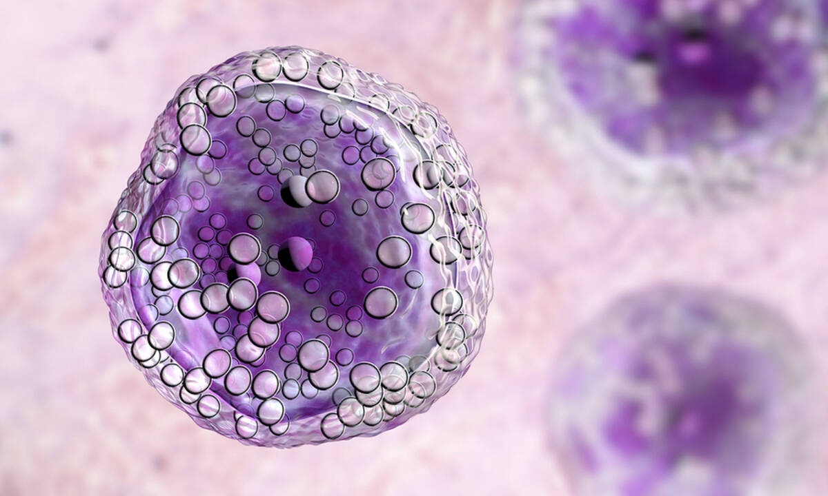 Λέμφωμα: Αναγνωρίστε το εγκαίρως από τα συμπτώματα (εικόνες)