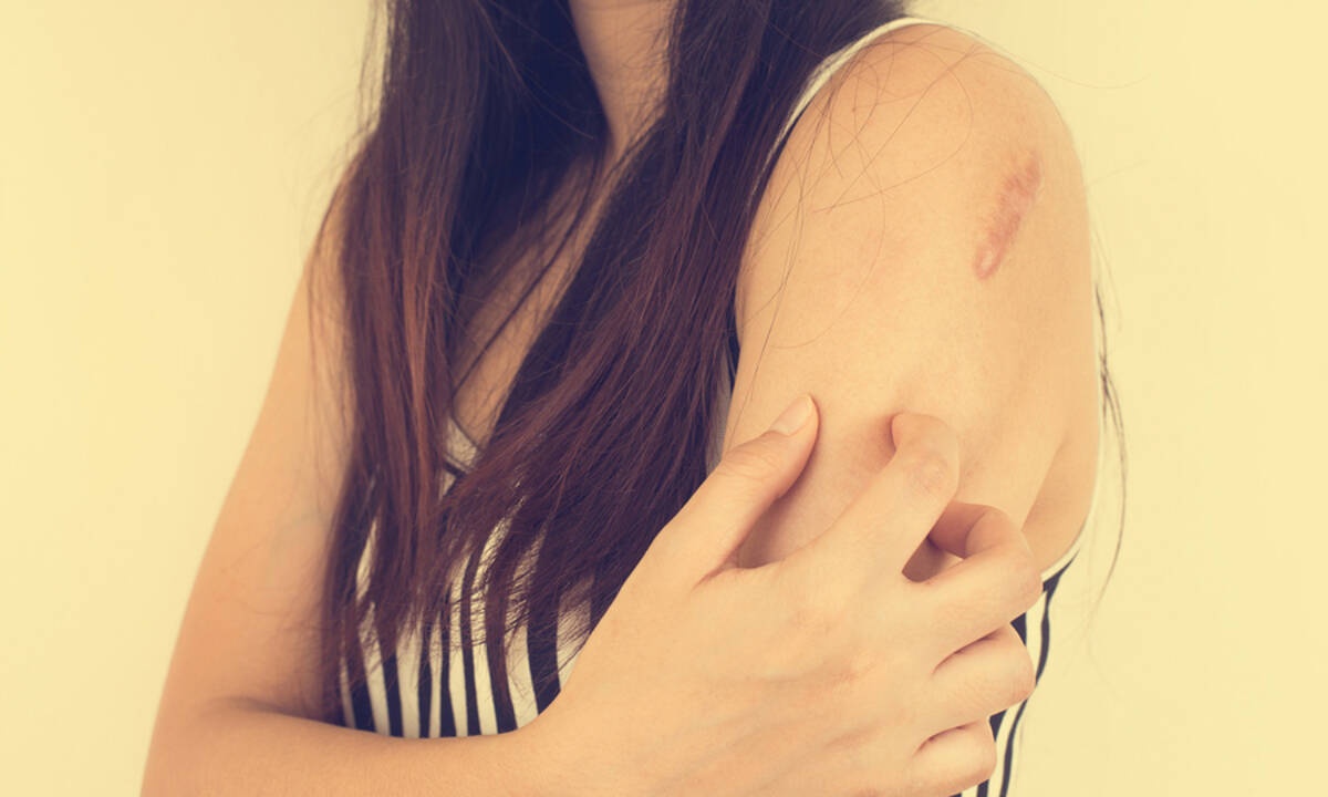 Δερματικά εξανθήματα: Αναγνωρίστε τα μέσα από φωτογραφίες