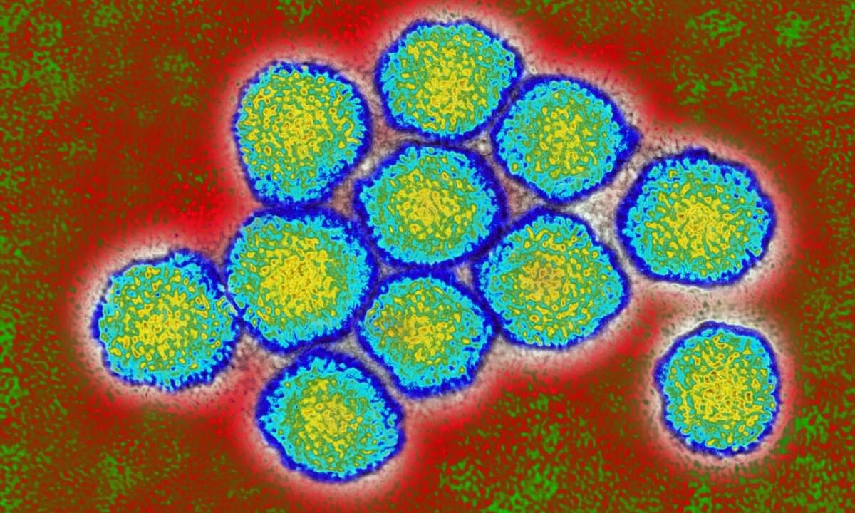 HIV, έρπης, HPV, ηπατίτιδα – Οι ιοί μέσα από εντυπωσιακές φωτογραφίες