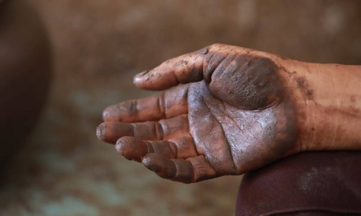 Ονειροκρίτης: Είδες στο όνειρό σου ότι ήσουν βρώμικος;