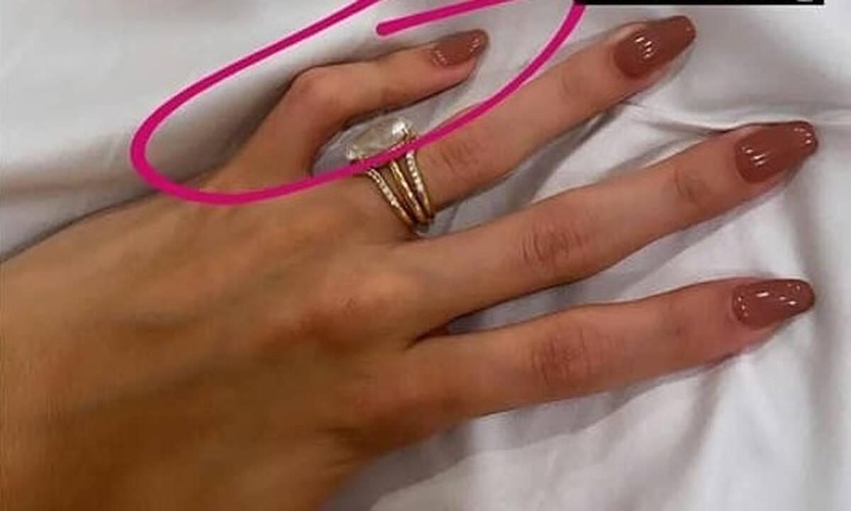 Το Instagram κορόιδευε τη Hailey Baldwin κι εκείνη αποκάλυψε τη δυσμορφία της