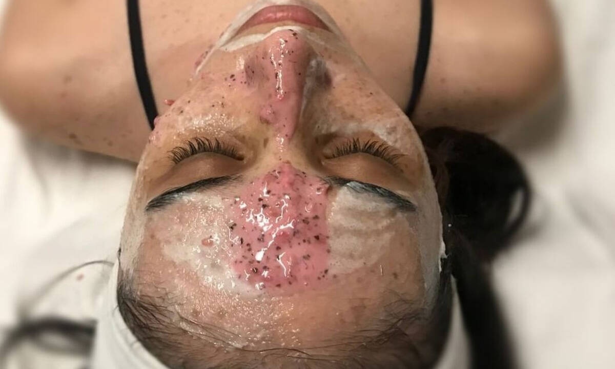 DIY: μάσκα προσώπου με φρέσκα φρούτα για τέλειο δέρμα