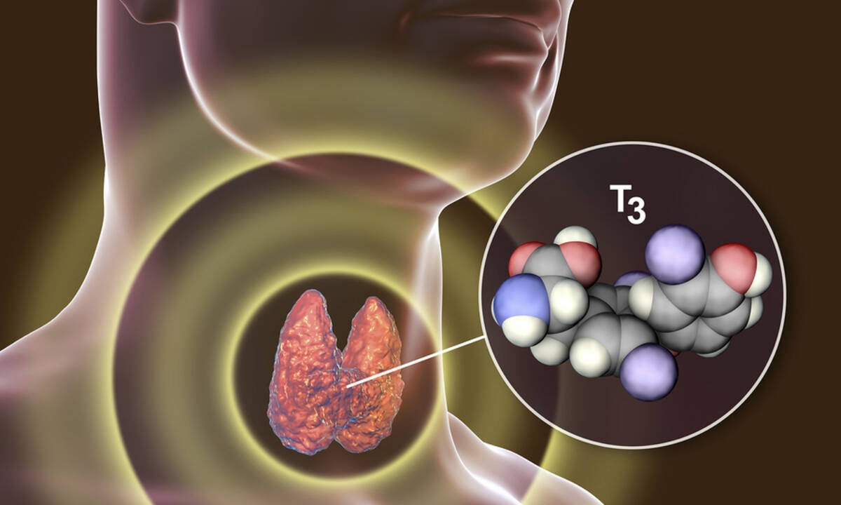 Θυρεοειδίτιδα Χασιμότο: Με ποια συμπτώματα εκδηλώνεται (εικόνες)