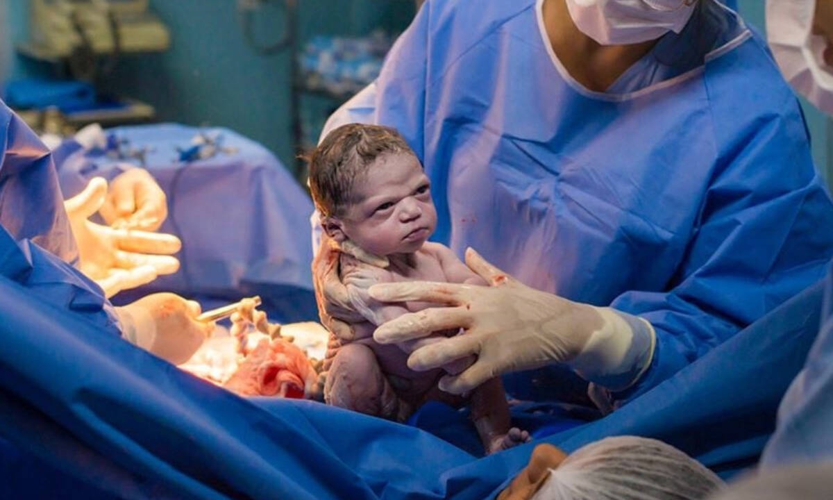 Αυτό το μωράκι έγινε viral γιατί γεννήθηκε… θυμωμένο (pics)