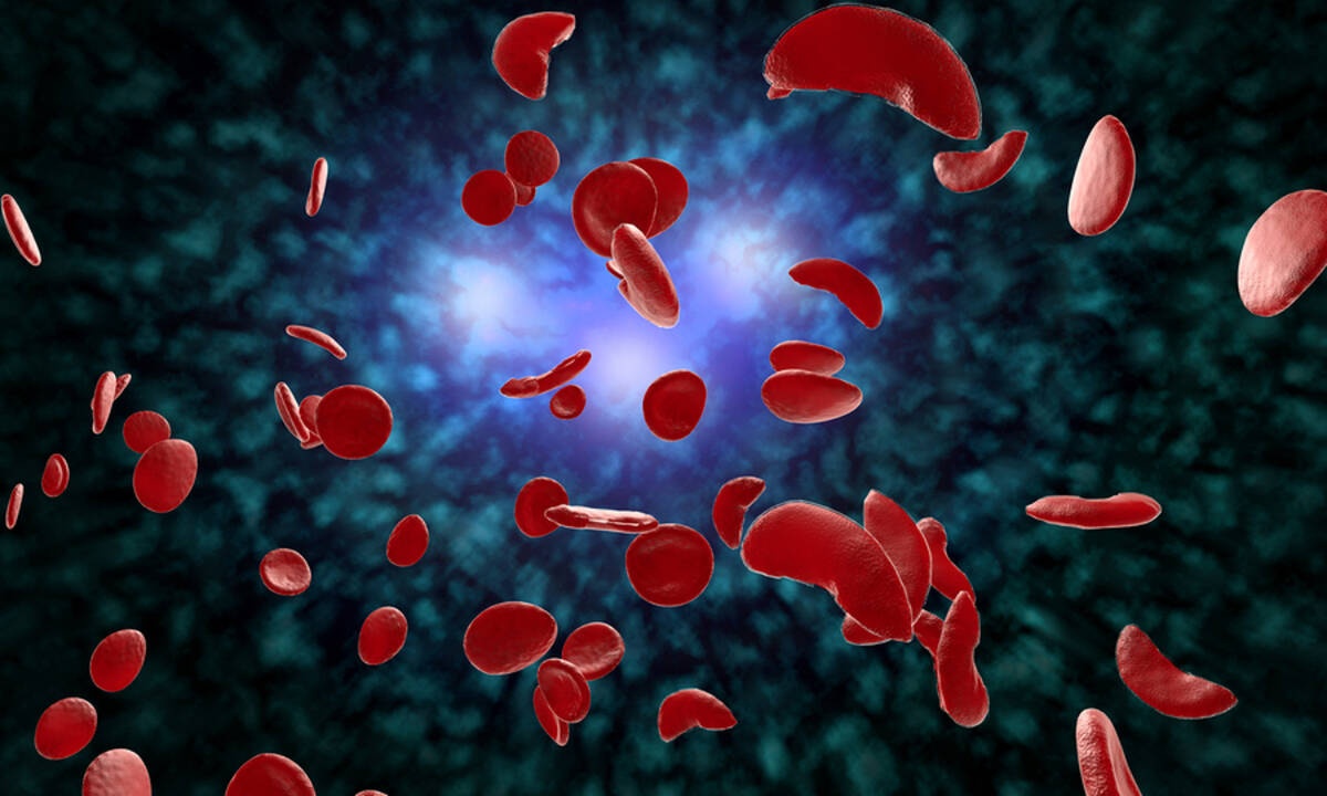 Αναιμία: Τι πρέπει να προσέξετε στη διατροφή σας (εικόνες)