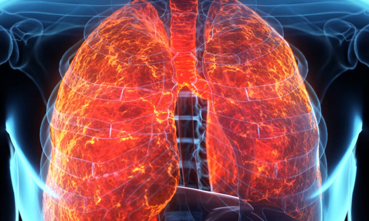 Υγρό στους πνεύμονες: Τα ανησυχητικά συμπτώματα (εικόνες)