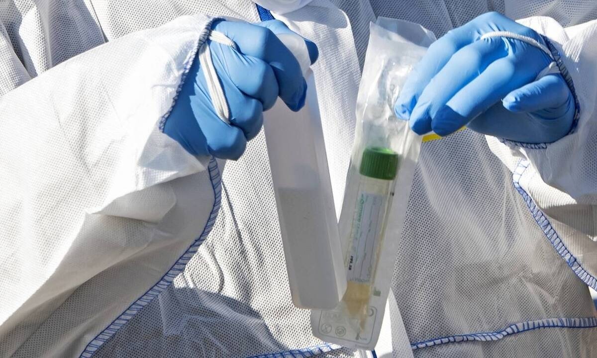Κορονοϊός: Ανατροπή με τα μοριακά τεστ - Γιατί ανησυχούν οι επιστήμονες