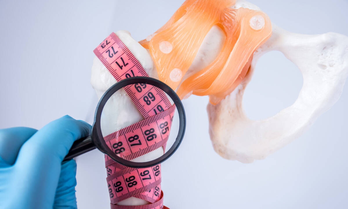 Οστεοπόρωση: Οι παράγοντες που αυξάνουν τον κίνδυνο (εικόνες)