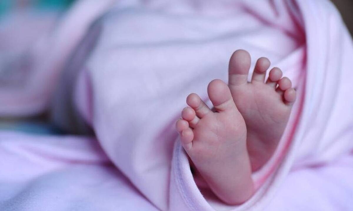 Γεννήθηκε μωρό με δυο στόματα - Δείτε τις εικόνες 