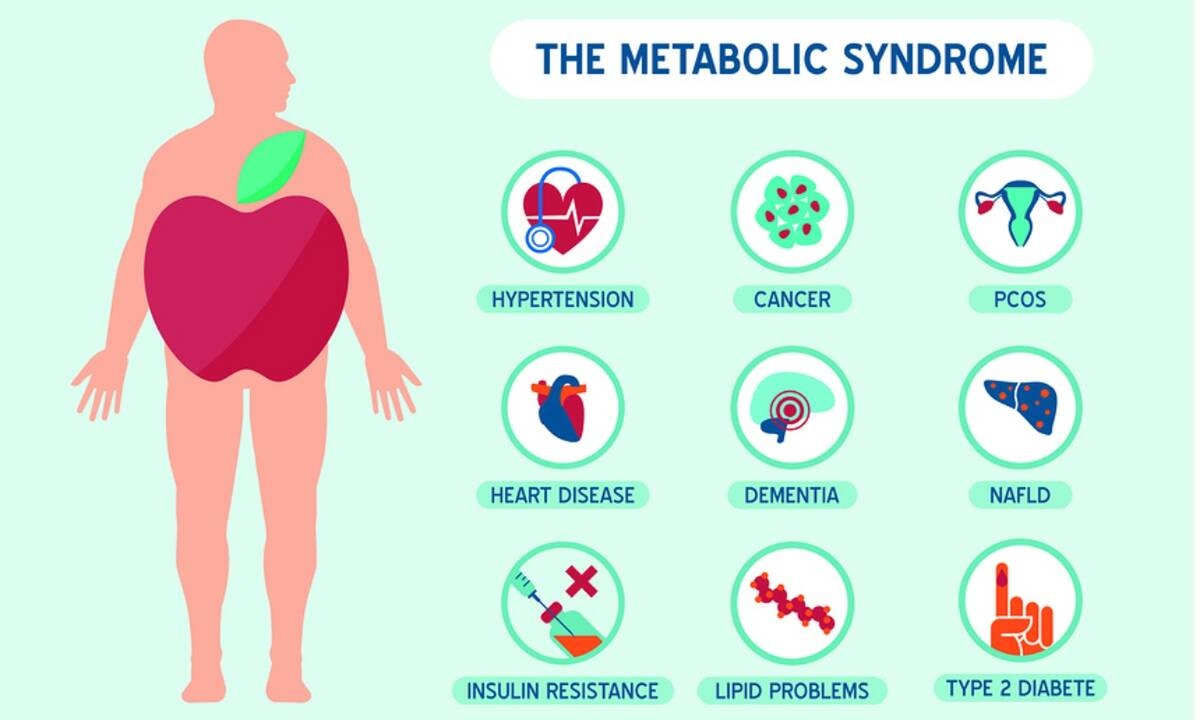 Μεταβολικό σύνδρομο: Τι περιλαμβάνει η διατροφή για τη μείωση του κινδύνου (έρευνα)