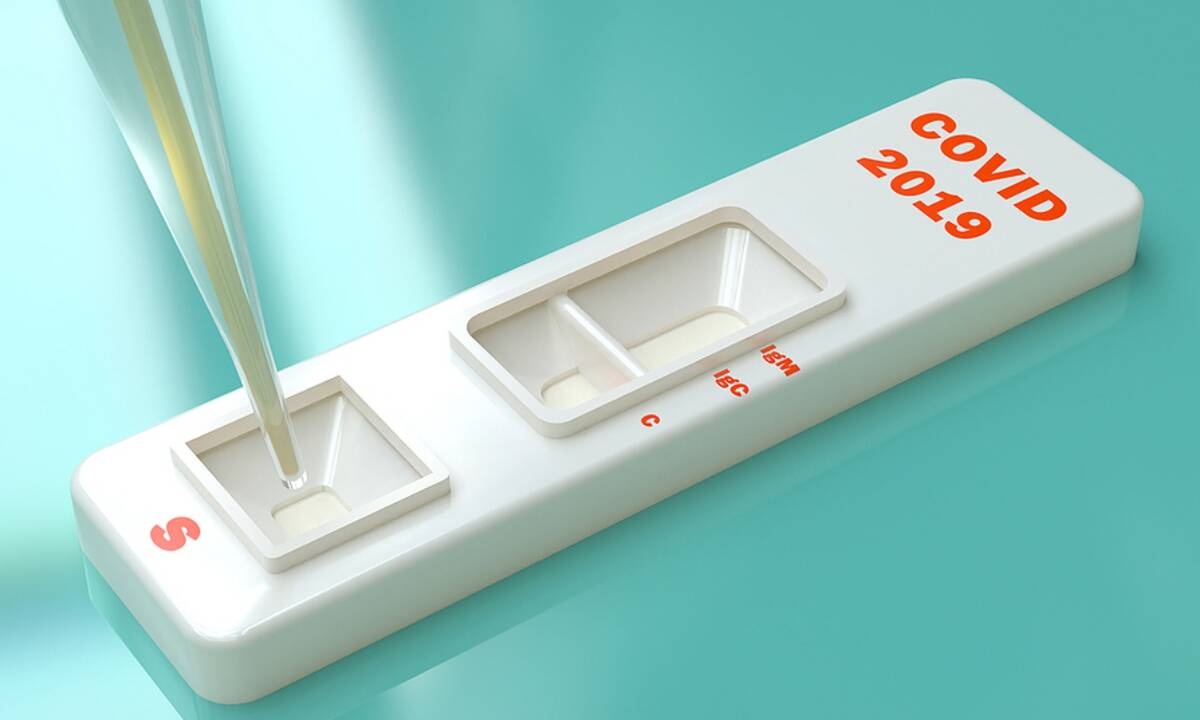 Κορονοϊός: Πόσο χρήσιμα είναι τα μαζικά τεστ αντισωμάτων