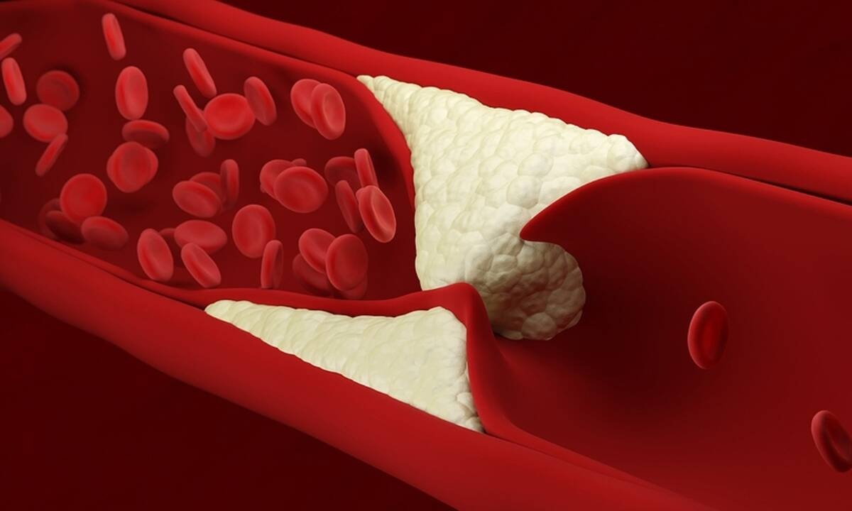 Πρόβλημα στην κυκλοφορία του αίματος: Τα ορατά σημάδια (εικόνες)