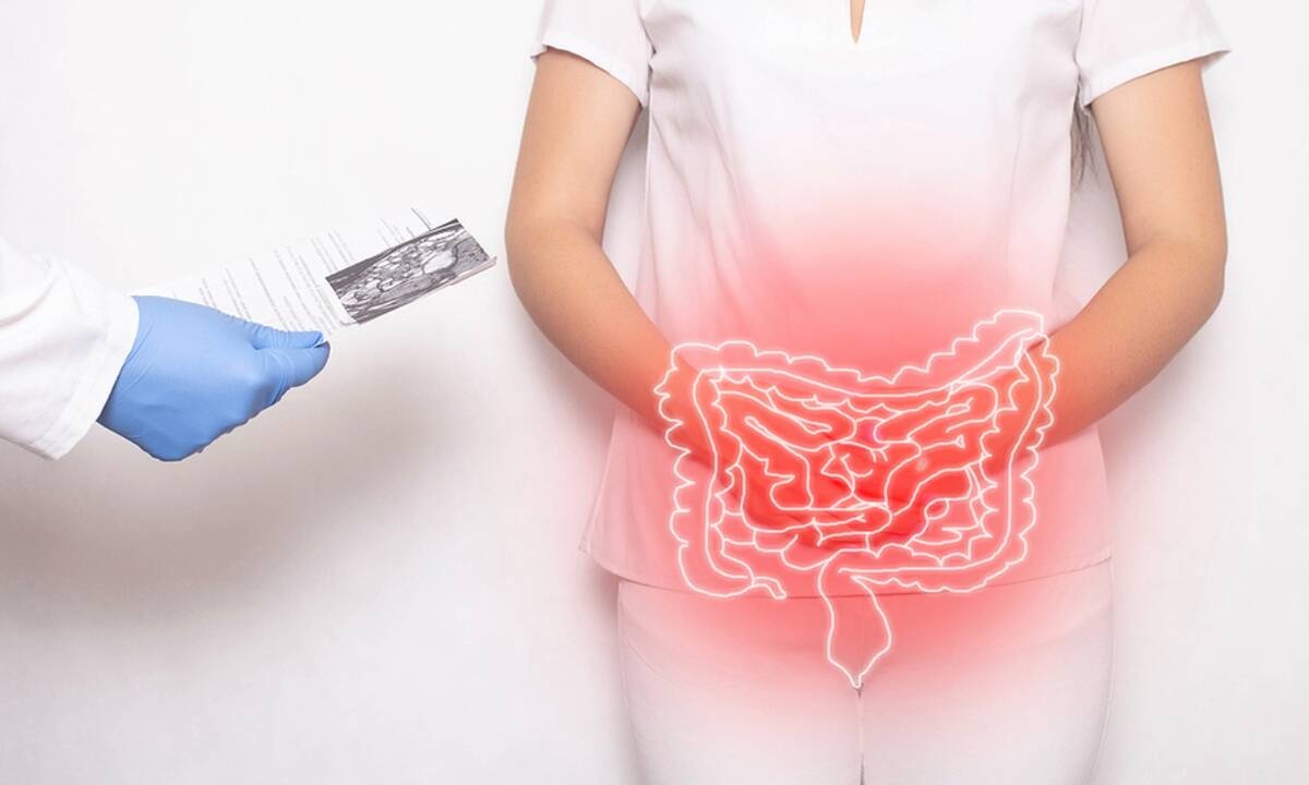 Φλεγμονή εντέρου: Με ποια συμπτώματα εκδηλώνεται (εικόνες)
