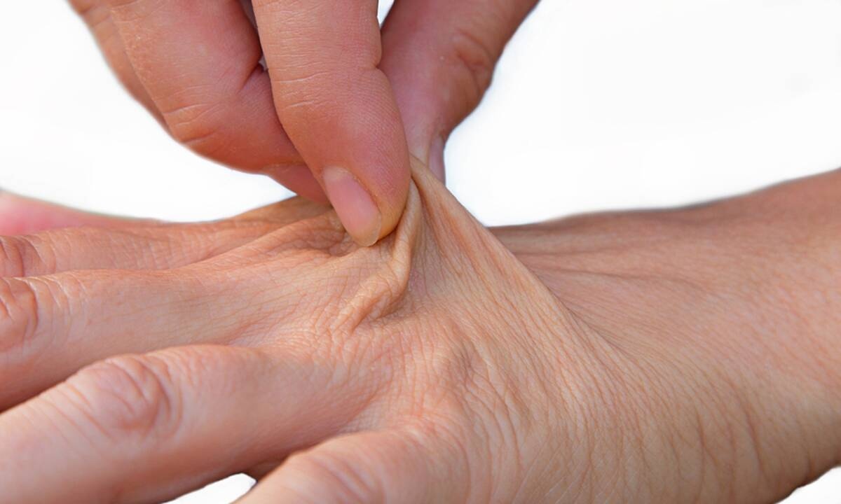 Πρόωρη γήρανση: Κατηγορίες τροφών που πυροδοτούν τη φλεγμονή & στεγνώνουν την επιδερμίδα (εικόνες)