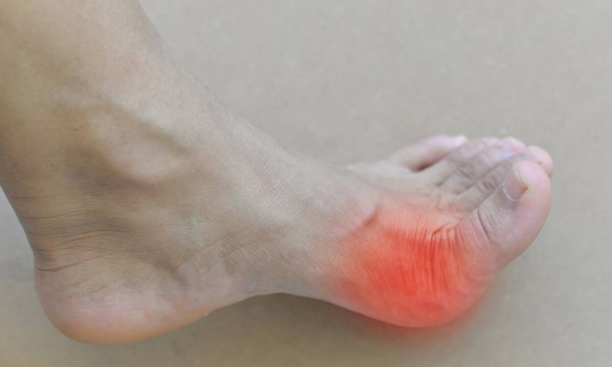 Ανεβασμένο ουρικό οξύ: Δείτε πώς θα το μειώσετε (εικόνες)