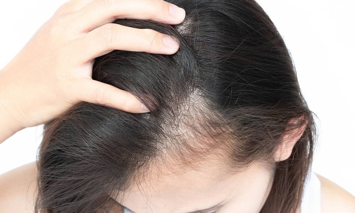 Αραίωση μαλλιών: Ποιες είναι οι πιθανές αιτίες (εικόνες)
