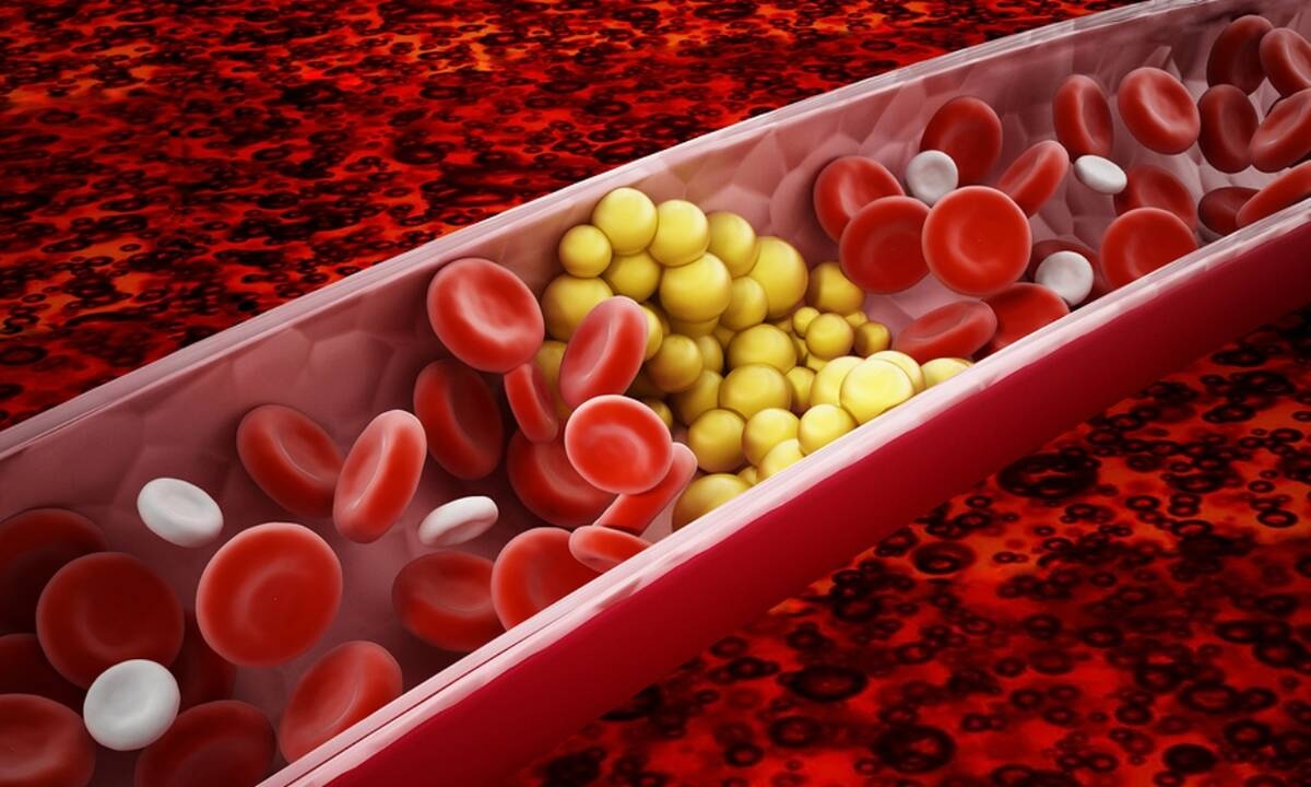 Xοληστερίνη: 8 τρόποι για να τη μειώσετε (εικόνες)