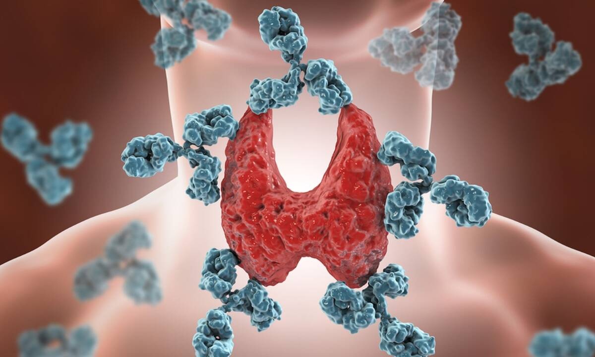 Υποθυρεοειδισμός: 8 συμπτώματα σε εικόνες