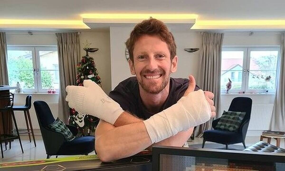 Ο Γκροζάν αποκαλύπτει τα τραύματα στα χέρια του μετά το σοκαριστικό ατύχημα