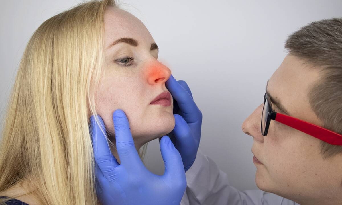 Κρεατάκια στη μύτη: Ποιες είναι οι πιθανές επιπτώσεις (εικόνες)