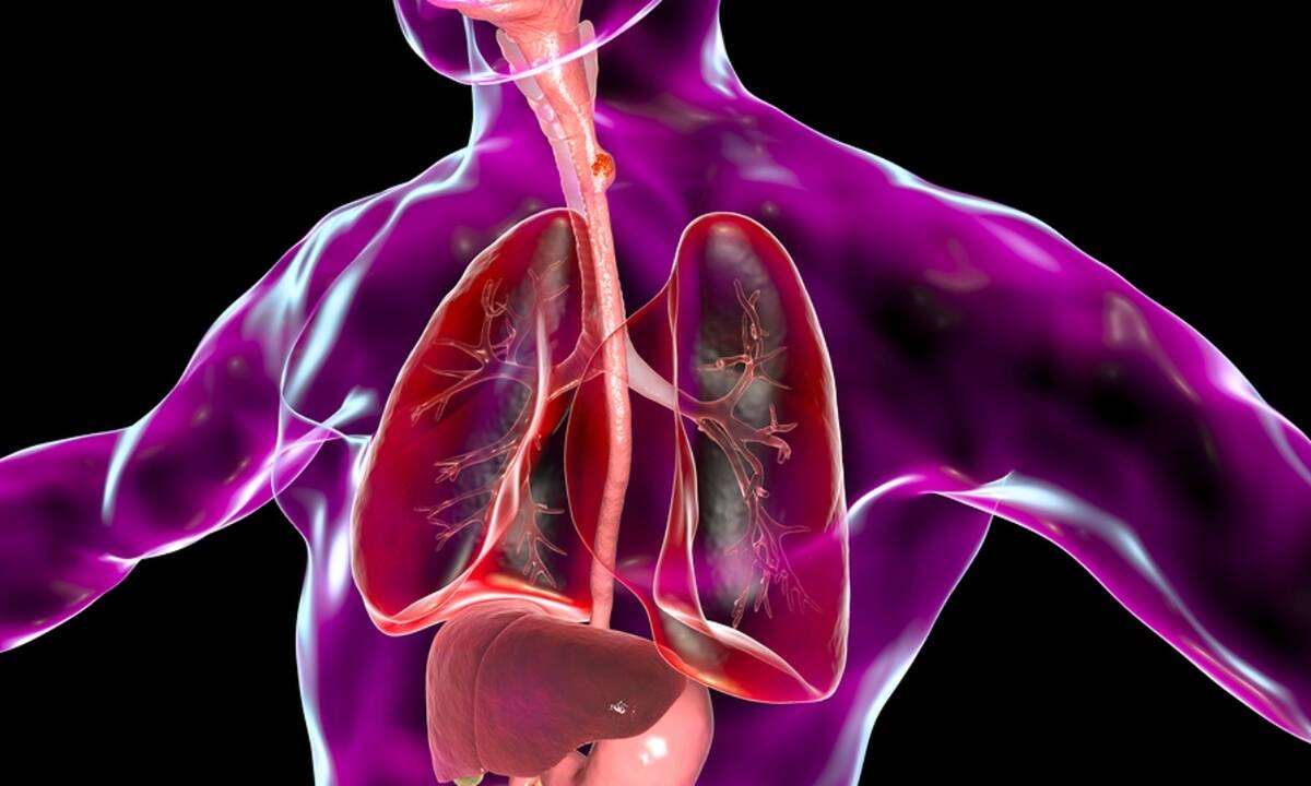 Καρκίνος οισοφάγου: 4 ύποπτα συμπτώματα (εικόνες)