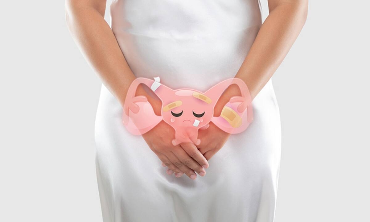 Κύστες στις ωοθήκες: Με ποια συμπτώματα εκδηλώνονται (εικόνες)