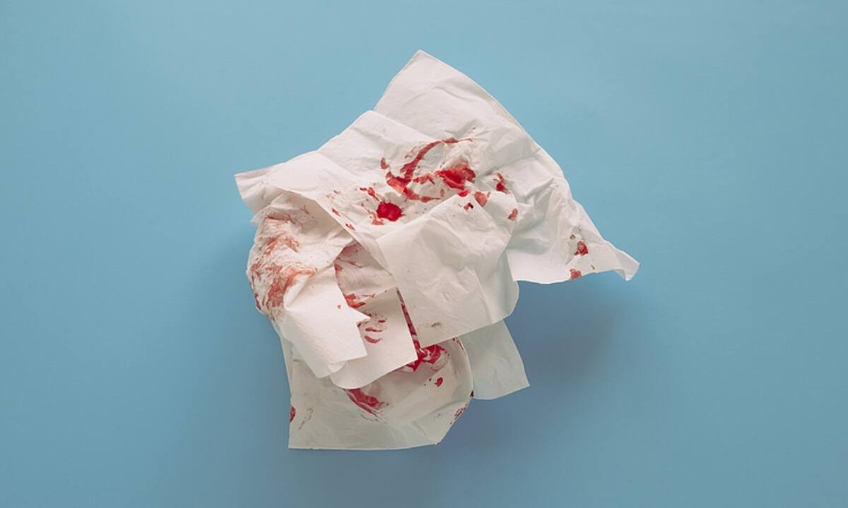 Αίμα από τη μύτη: Για ποιες παθήσεις προειδοποιεί (εικόνες)