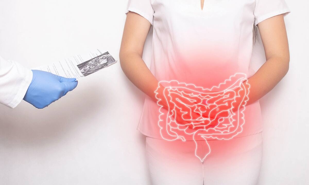 Φλεγμονή εντέρου: Με ποια συμπτώματα εκδηλώνεται (εικόνες)
