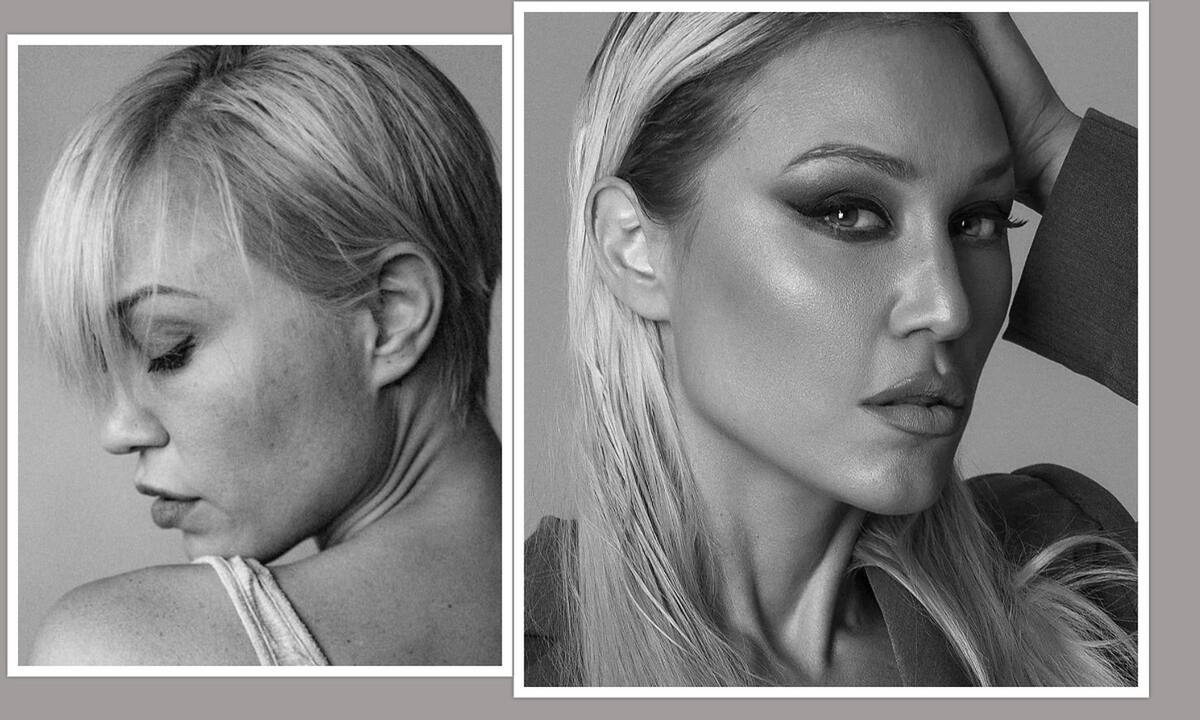 Πηνελόπη Αναστασοπούλου: «Άρχισαν να πέφτουν τα μαλλιά μου μετά τον κορονοϊό, γι΄αυτό τα έκοψα»