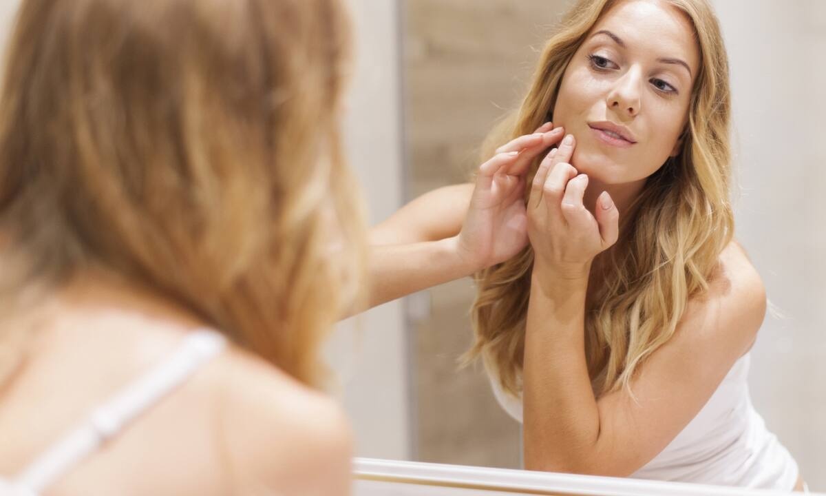 Ακμή: 4 τοπικές θεραπείες για να την αντιμετωπίσεις