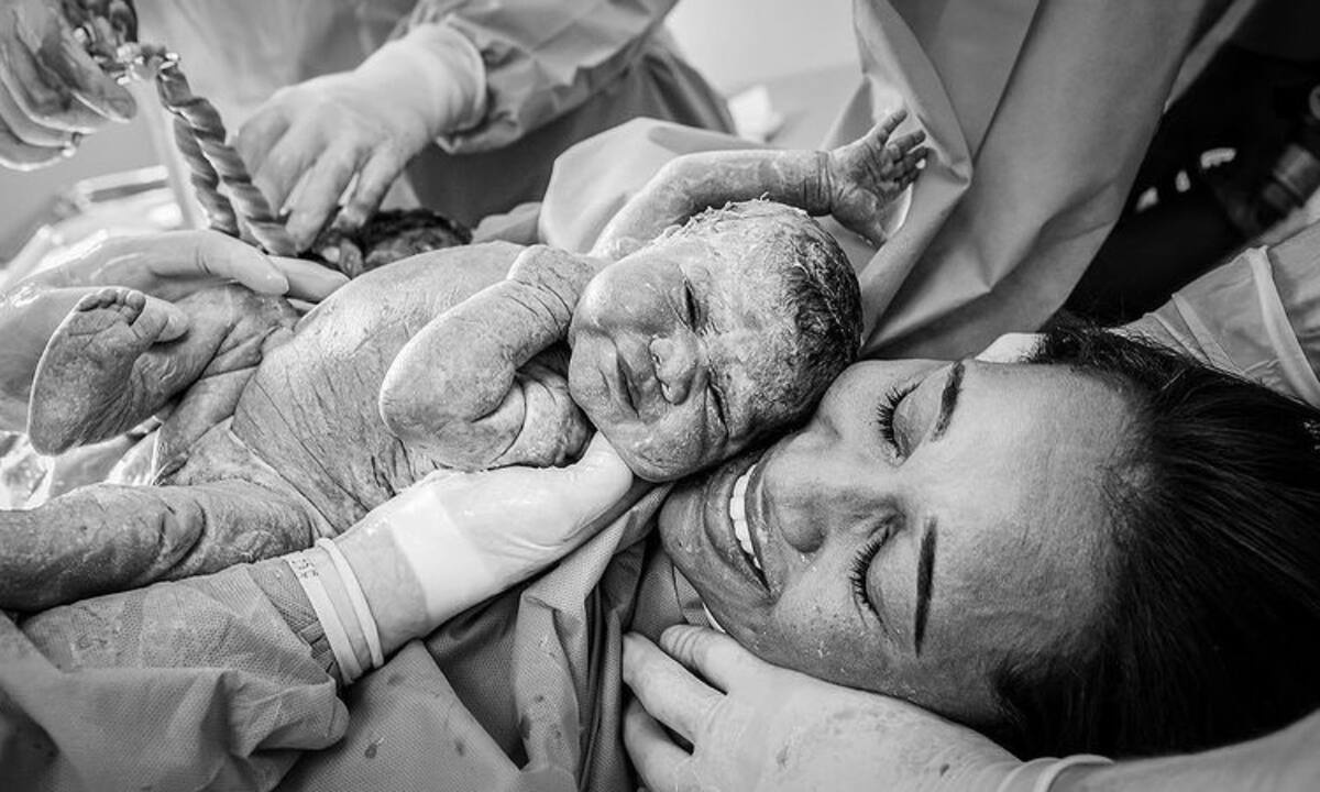 Τοκετός με καισαρική: Είναι εξίσου μοναδικός και αυτές οι φωτο το αποδεικνύουν