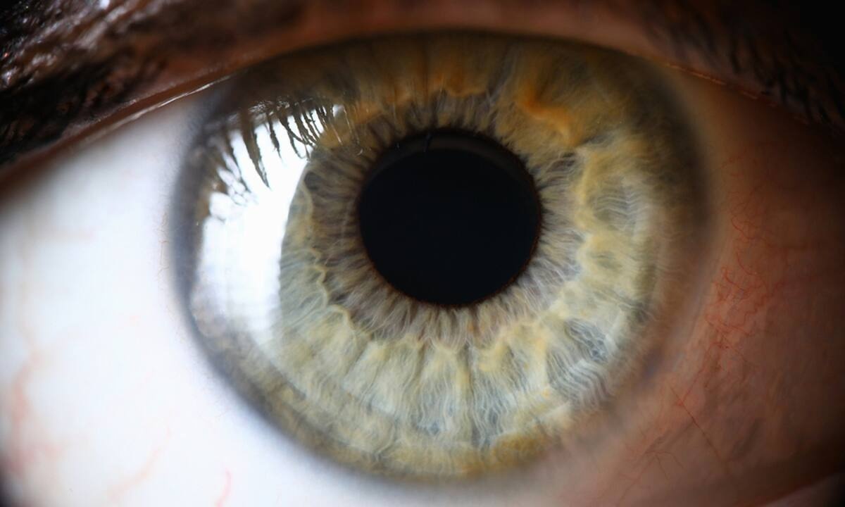 Οι σοβαρές παθήσεις που φαίνονται στα μάτια σας (εικόνες)