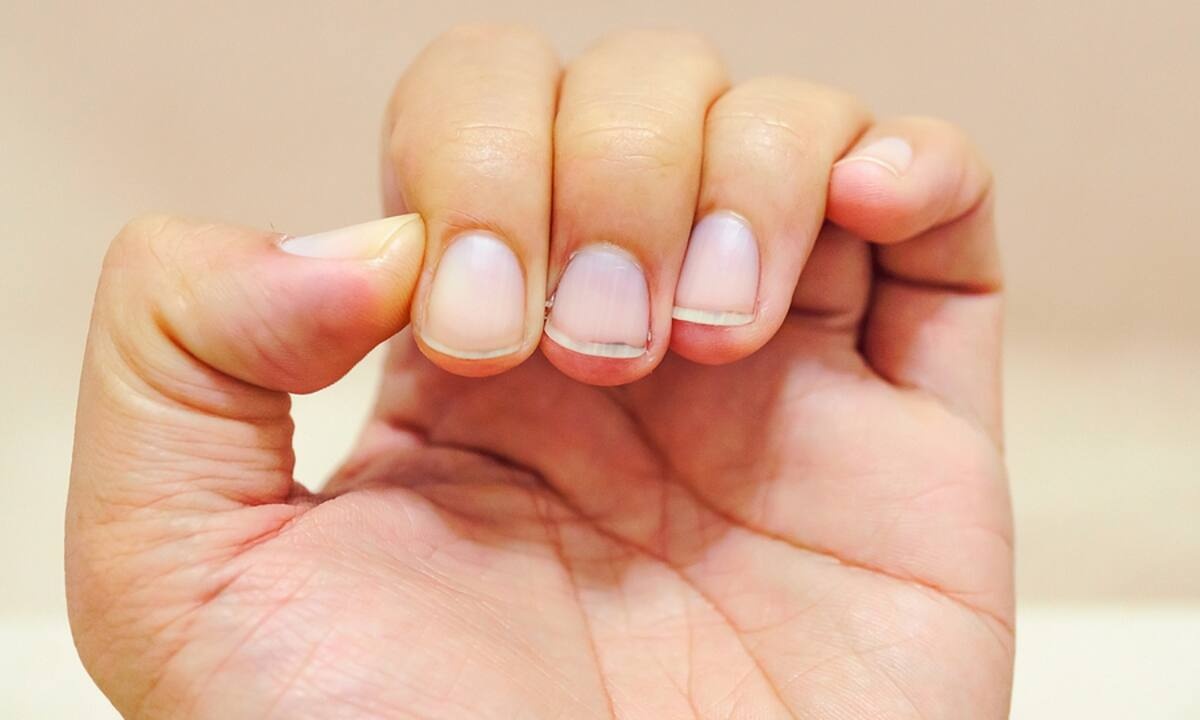 Διαταραχές νυχιών: Τι αποκαλύπτουν για την υγεία (εικόνες)