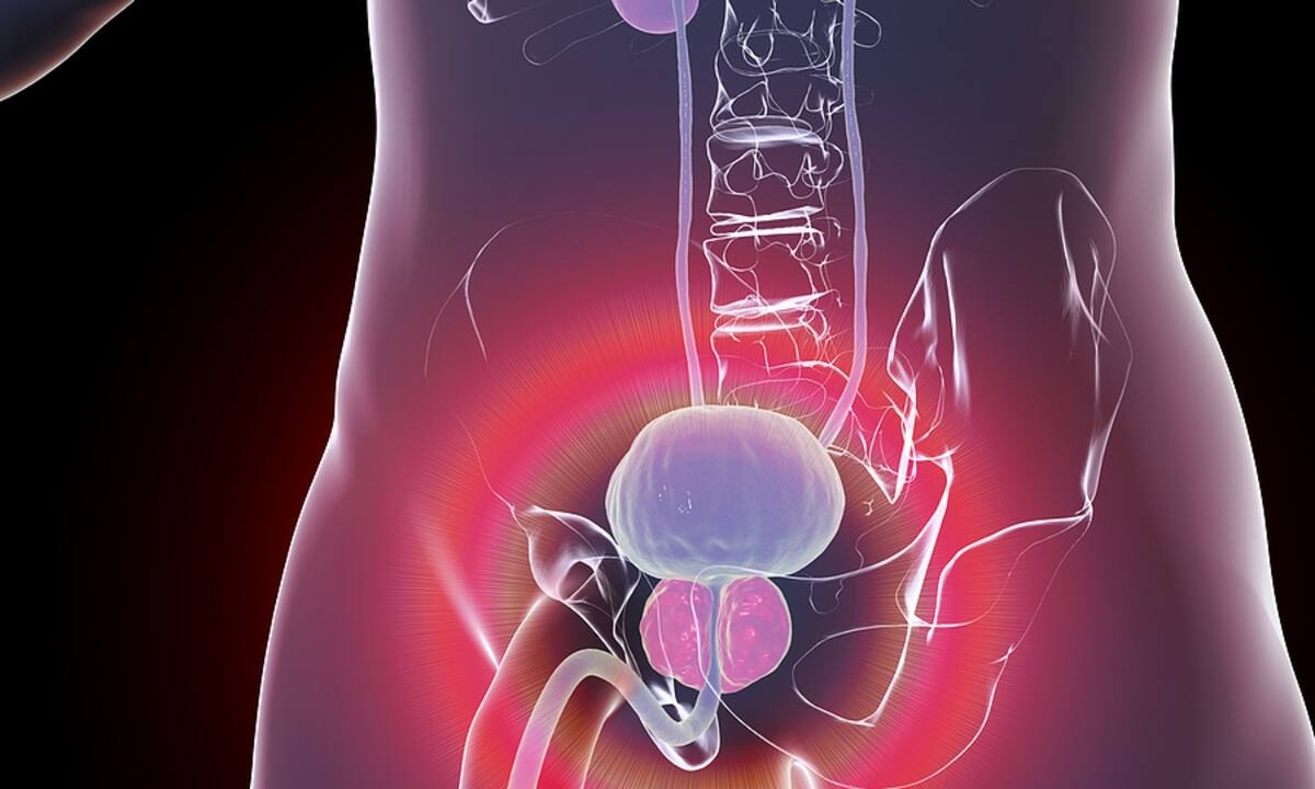 Καλοήθης υπερπλασία προστάτη: Πώς θα βελτιώσετε φυσικά τα συμπτώματα (εικόνες)