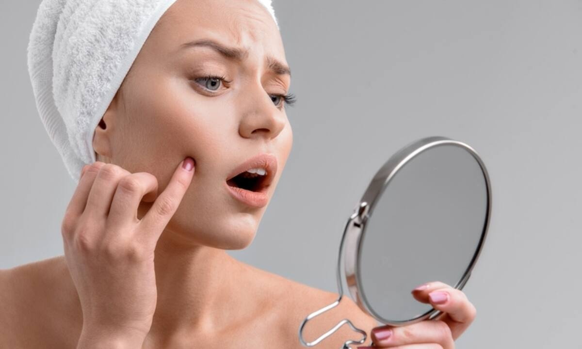 Σπυράκι με πύον: Τα 5 απλά βήματα για να το εξαφανίσεις (εικόνες)