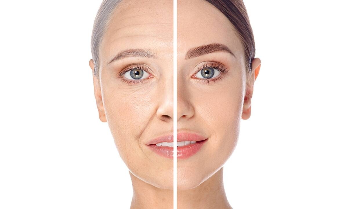 9 λόγοι που η επιδερμίδα σας γερνάει πρόωρα (video)