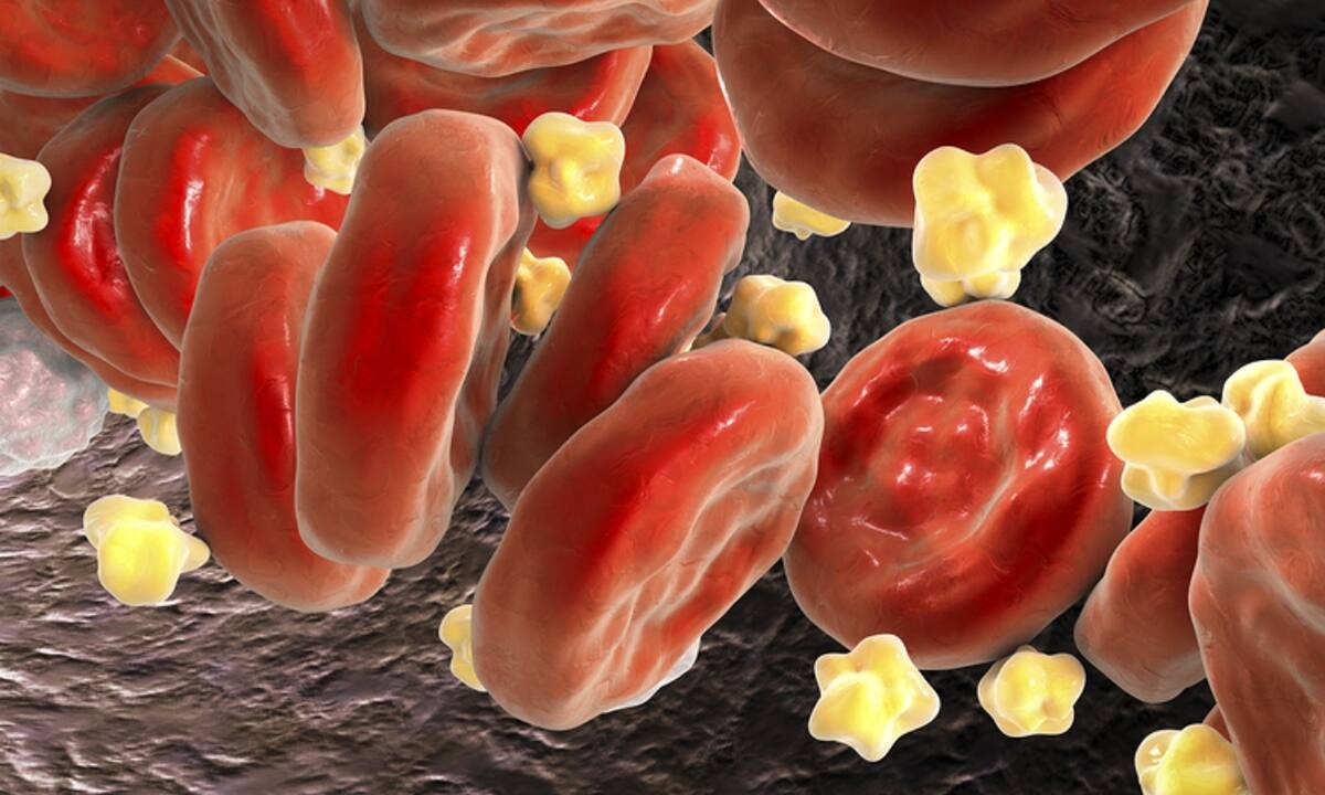 Πέντε πανεύκολα βήματα για τη μείωση της χοληστερίνης (εικόνες)