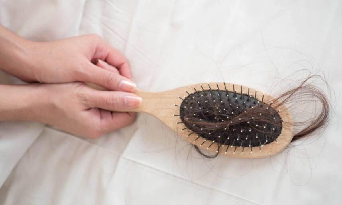 Τριχόπτωση: 16 απίθανοι λόγοι που πέφτουν τα μαλλιά σας (εικόνες)